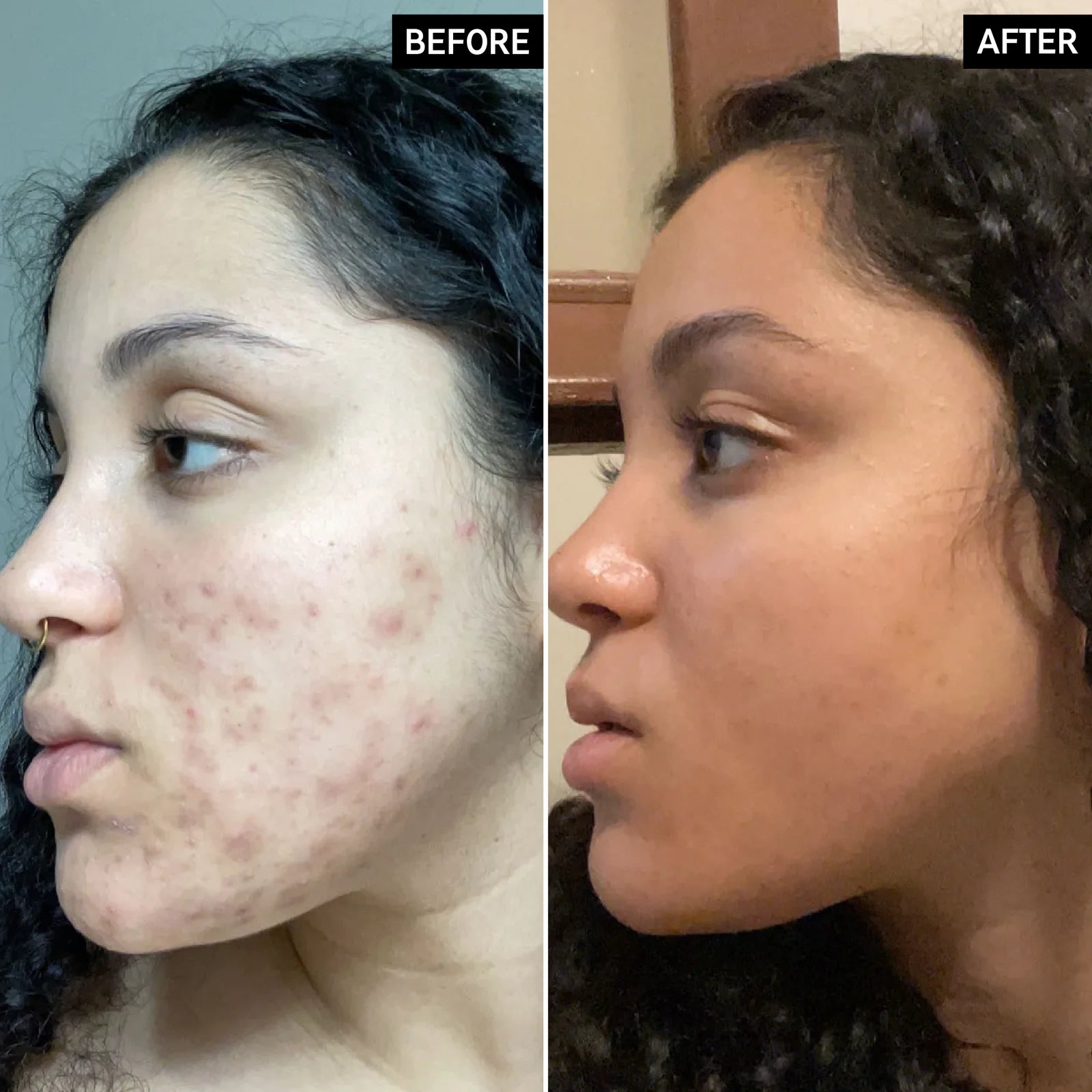 Results of Face Serum